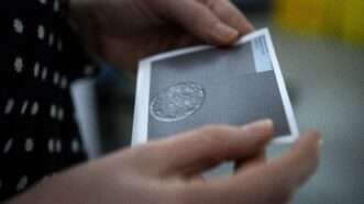 woman holding photo of frozen embryo | AMELIE-BENOIST / IMAGE POINT FR / BSIP/BSIP/Universal Images Group/Newscom