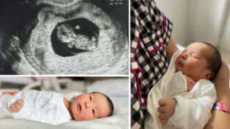 Collage of a pregnancy and a newborn baby | Gameto