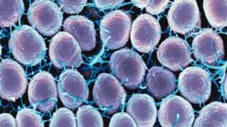 gonorrhea-causing bacteria | Photo by <a href="https://unsplash.com/@niaid?utm_content=creditCopyText&utm_medium=referral&utm_source=unsplash">National Institute of Allergy and Infectious Diseases</a> on <a href="https://unsplash.com/photos/a-close-up-of-a-bunch-of-cell-phones-nNkC8NDOxs8?utm_content=creditCopyText&utm_medium=referral&utm_source=unsplash">Unsplash</a>       