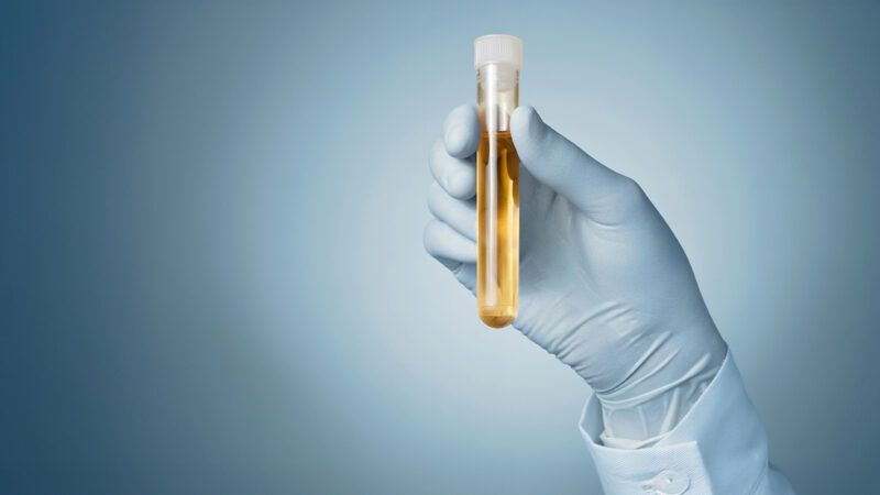 A gloved hand holding a vial of yellow liquid | Photo: Vonschonertagen/iStock